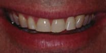 Before Smile – Brian